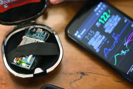 Le pancréas artificiel a été fabriqué à partir d’un micro-ordinateur Edison d’Intel. Il contrôle un capteur de taux de glucose et une pompe à insuline qui est pilotée par des algorithmes. © Sandy Huffaker, Wall Street Journal Le pancréas artificiel a été fabriqué à partir d’un micro-ordinateur Edison d’Intel. Il contrôle un capteur de taux de glucose et une pompe à insuline qui est pilotée par des algorithmes. © Sandy Huffaker, Wall Street Journal
