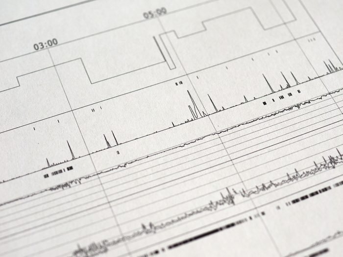 Faites des tests de dépistage pour savoir si vous avez des troubles du sommeil comme l'apnée.