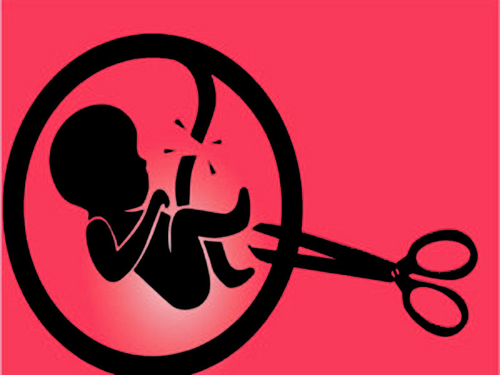 Jenis Aborsi Kandungan Melalui Dokter