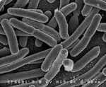Chapitre 11:  La contamination par les Micro-organismes : la réaction inflammatoire 