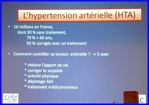 Une conférence sur l'Accident Vasculaire Cérébral (AVC) a été proposée aux visiteurs du Forum des Séniors 