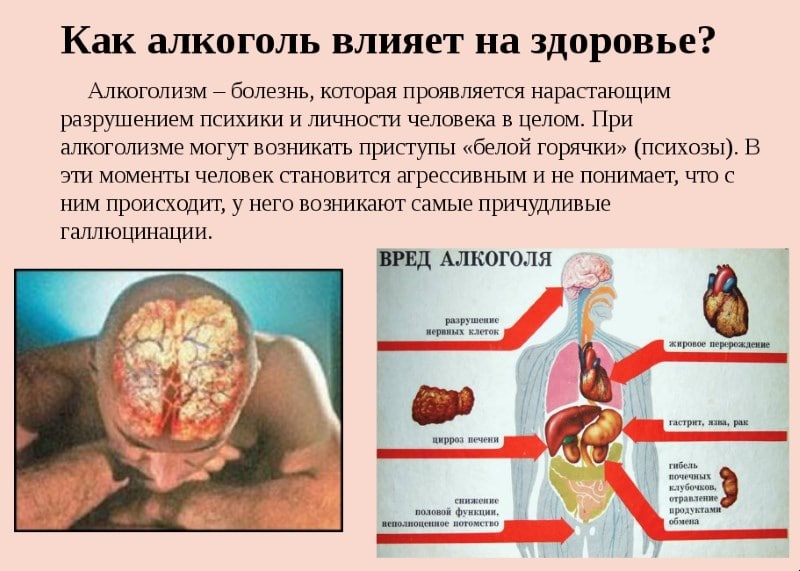 за и против кодирования от алкоголизма