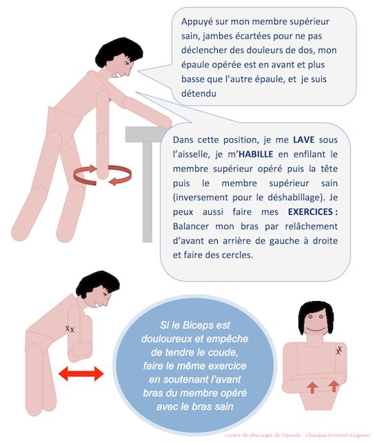 exercice pendulaire_épaule opérée coiffe, stade 1