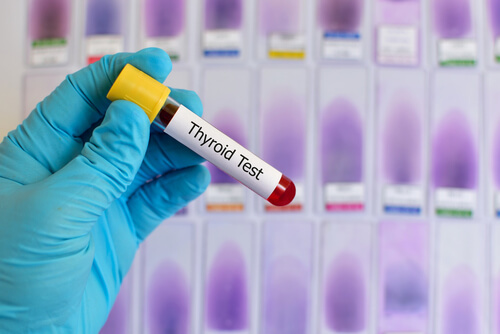 test hormones thyroïde