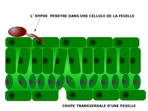 infection 3