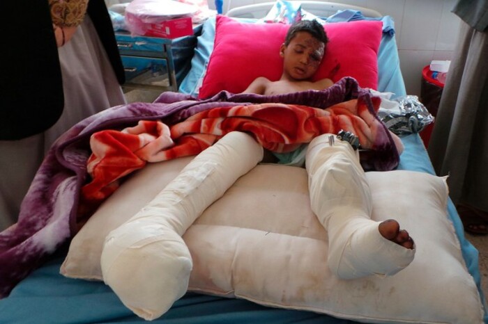 L’Arabie saoudite massacre des enfants avec des armes françaises ***  Yémen : environ 10 000 morts et un drame humanitaire