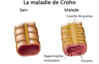 rencontre maladie de crohn