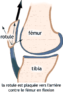 Rotule (sd femoro-patellaire).gif