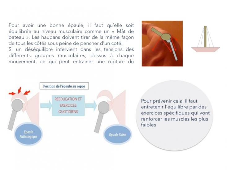 principes de généraux de rééducation de l'épaule