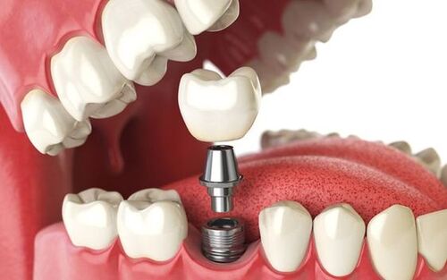 Diagnostic et thérapie en orthodontie dentaire
