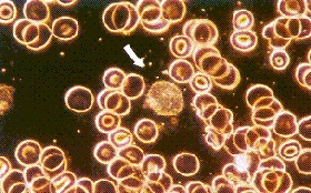 BECHAMP / PASTEUR