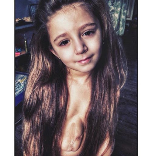 Virsaviya, cette adorable fillette qui se bat chaque jour contre cette maladie
