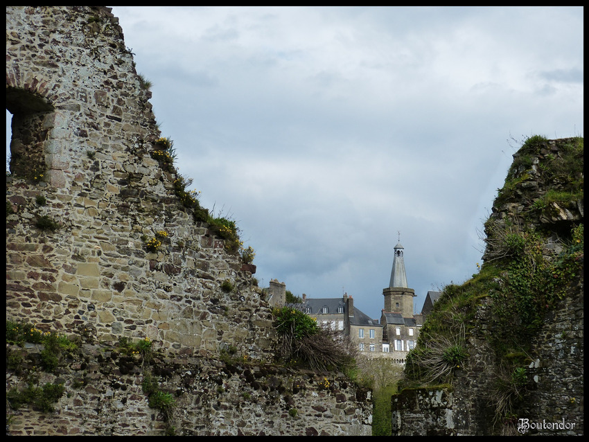 Fougères : Le château serie 1