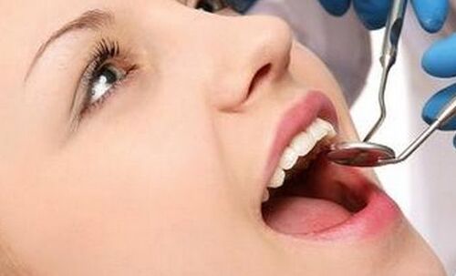 Inconvénients de blanchiment des dents