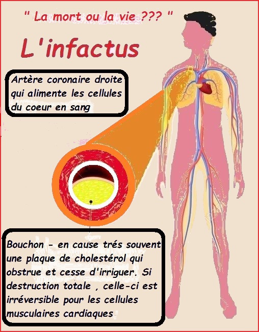 L'après-midi noire de ce 21 Avril 2018........l'infactus