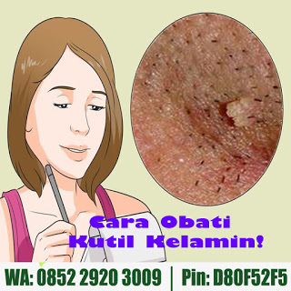 obat kutil kelamin obat kutil kelamin