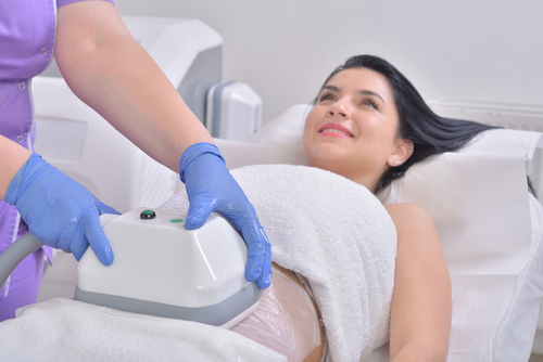 CoolSculpting, c’est quoi ?