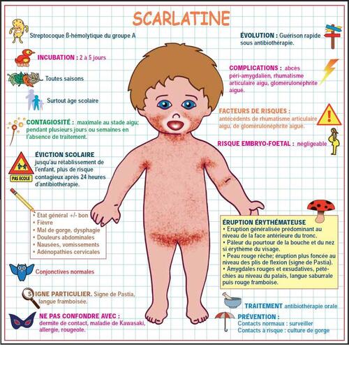 Scarlatine