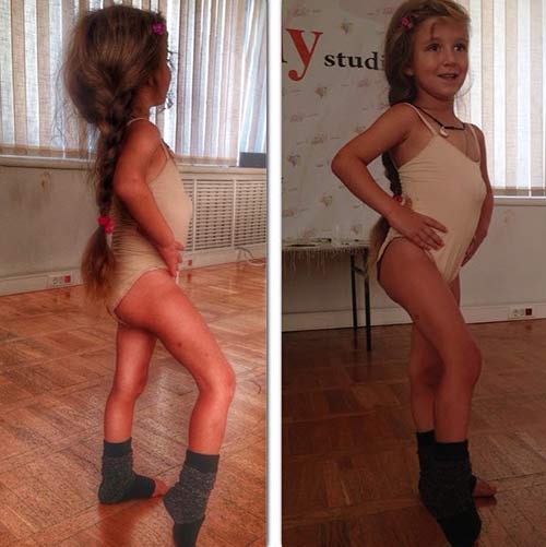 Virsaviya, cette adorable fillette qui se bat chaque jour contre cette maladie