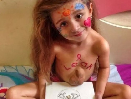 Virsaviya, cette adorable fillette qui se bat chaque jour contre cette maladie