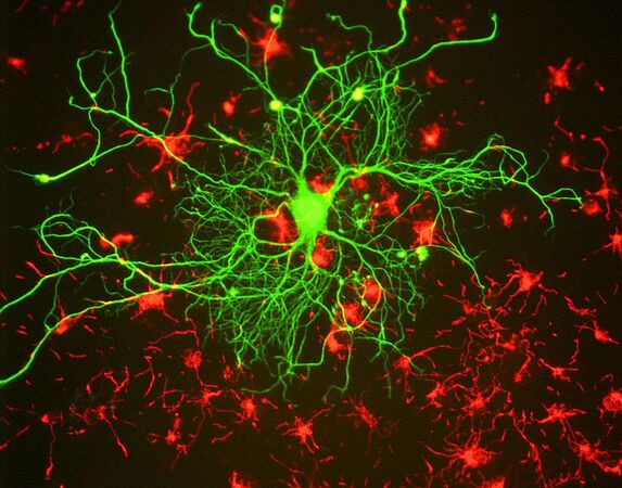 Le neurone est une cellule différenciée qu’on imagine mal se former à partir d’une cellule rectale. © GerryShaw, Wikimedia Commons, cc by sa 3.0