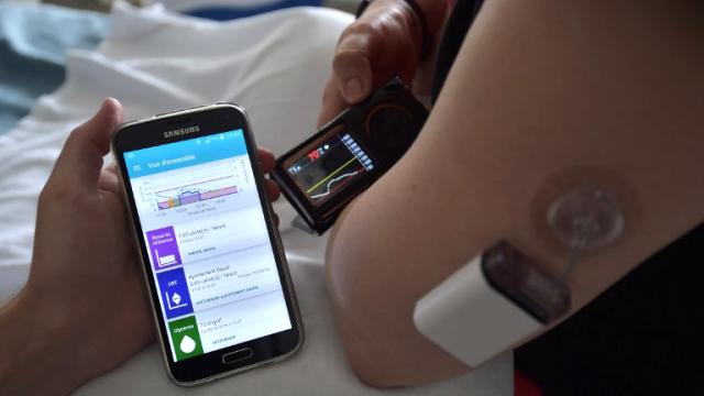 Un « pancréas artificiel », actuellement testé par 45 malades dans neuf hôpitaux en France, pourrait changer la vie des diabétiques.