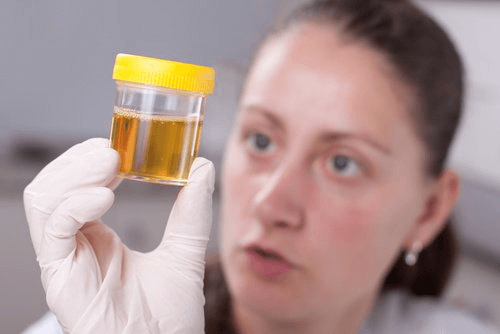 flacon d'urine
