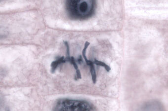 File:Allium-Mitose03-DM100x BL28.jpg