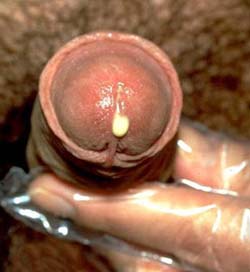 obat kencing nanah di apotik ampuh dan mujarab obat kencing nanah di apotik ampuh dan mujarab