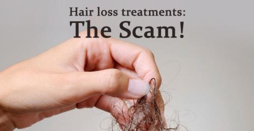 HAIR LOSS TREATMENTS: THE SCAM!