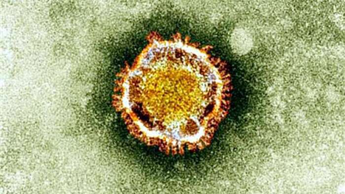 Coronavirus: que change le déclenchement du stade 3 ?