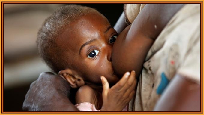 MALNUTRITION EN RDC