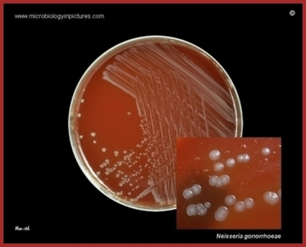 Les Microbes.