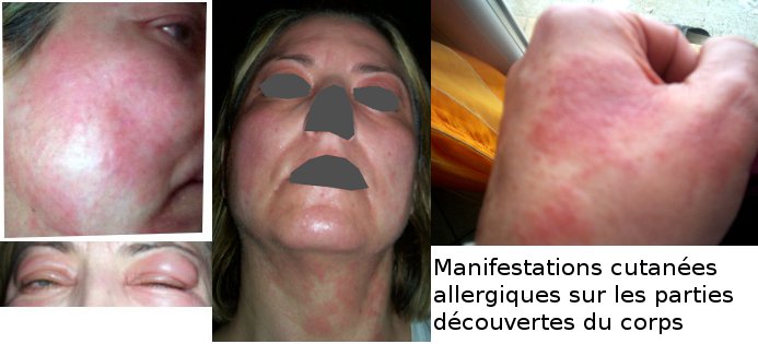 Maquillage sans parfum d'une peau allergique (le teint) - Beauté des peaux  réactives