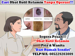 Obat Kutil Kelamin, Cara Mengobati Kutil Dikemaluan Kelamin Dari Rumah Sendiri, Dokter Obat Kutil Kelamin Terbukti Terbaik Dan Terpercaya Obat Kutil Kelamin, Cara Mengobati Kutil Dikemaluan Kelamin Dari Rumah Sendiri, Dokter Obat Kutil Kelamin Terbukti Terbaik Dan Terpercaya