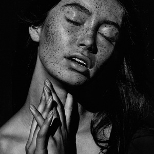 Carsten Witte, The Freckles Project