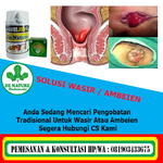 obat ambeyen atau wasir