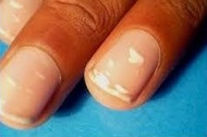 0-Info Ongles bizarres