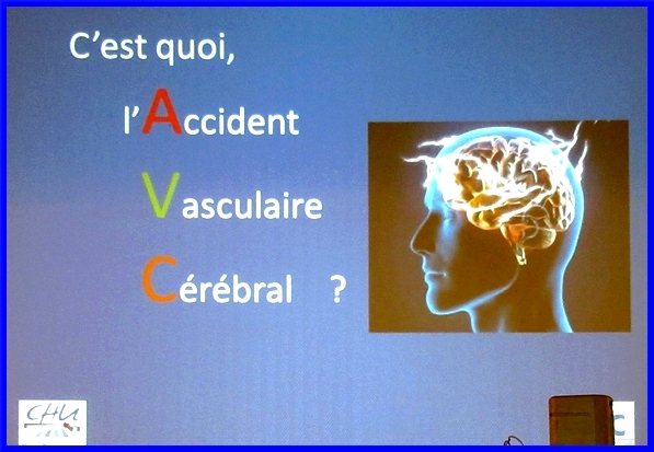 Une conférence sur l'Accident Vasculaire Cérébral (AVC) a été proposée aux visiteurs du Forum des Séniors 