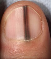 0-Info Ongles bizarres