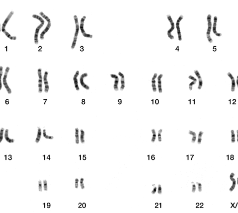 File:DNA human male chromosomes.gif