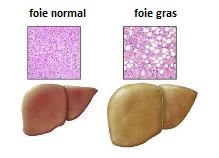 Togliere posti da rimedi di gente di acne