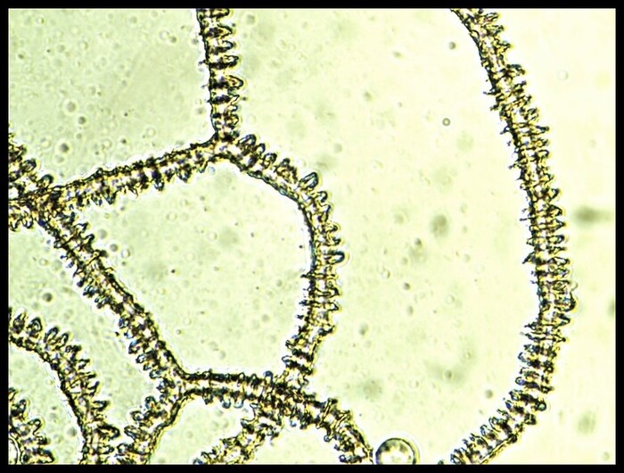 Myxomycètes blancs.