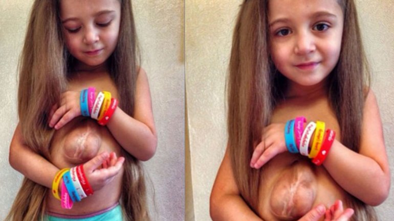 Virsaviya, cette adorable fillette qui se bat chaque jour contre cette maladie