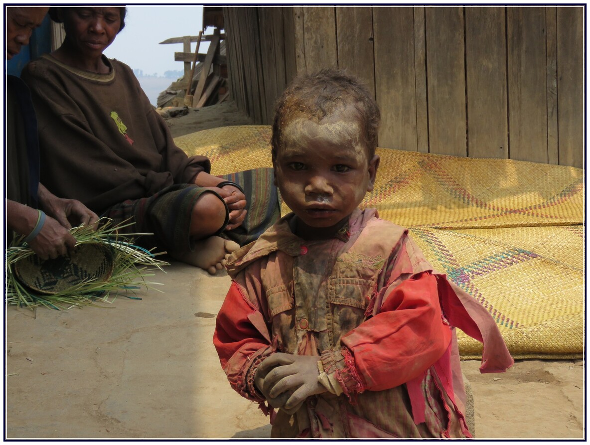 VISAGES  D'ENFANTS  MALGACHE