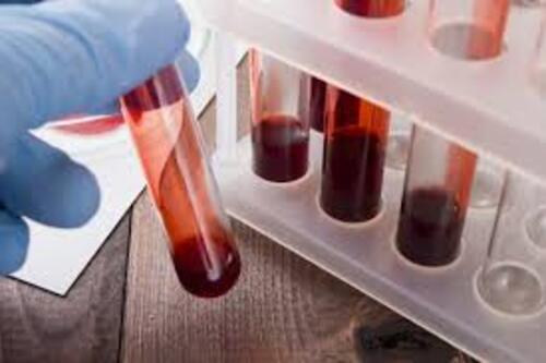Un test sanguin pour détecter le cancer ?