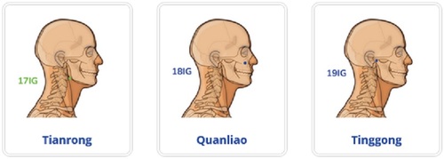 3 Points d'acupuncture du méridien Intestin Grêle.jpg