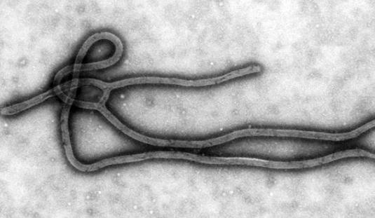 Le virus Ebola va-t-il sévir en Europe ?