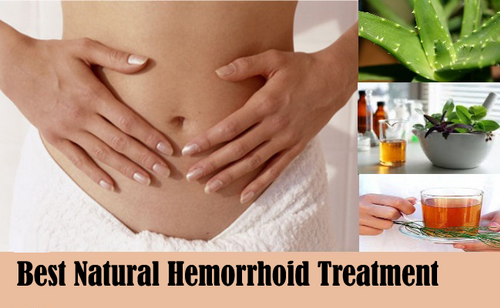 Hemorrhoid Remedy: Easy Tips You May Not Know
