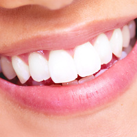 Dents blanches, saines et haleine fraîche : Argile Verte - NATURELLEMENT  BIEN
